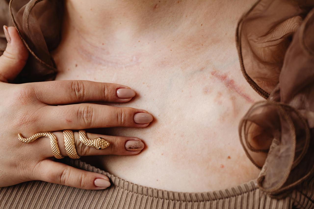 What It’s Like To Be In An Abusive Relationship